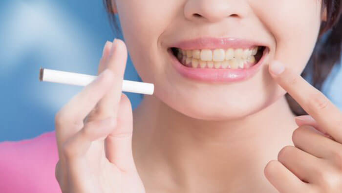how to smoke after tooth extraction without getting dry socket